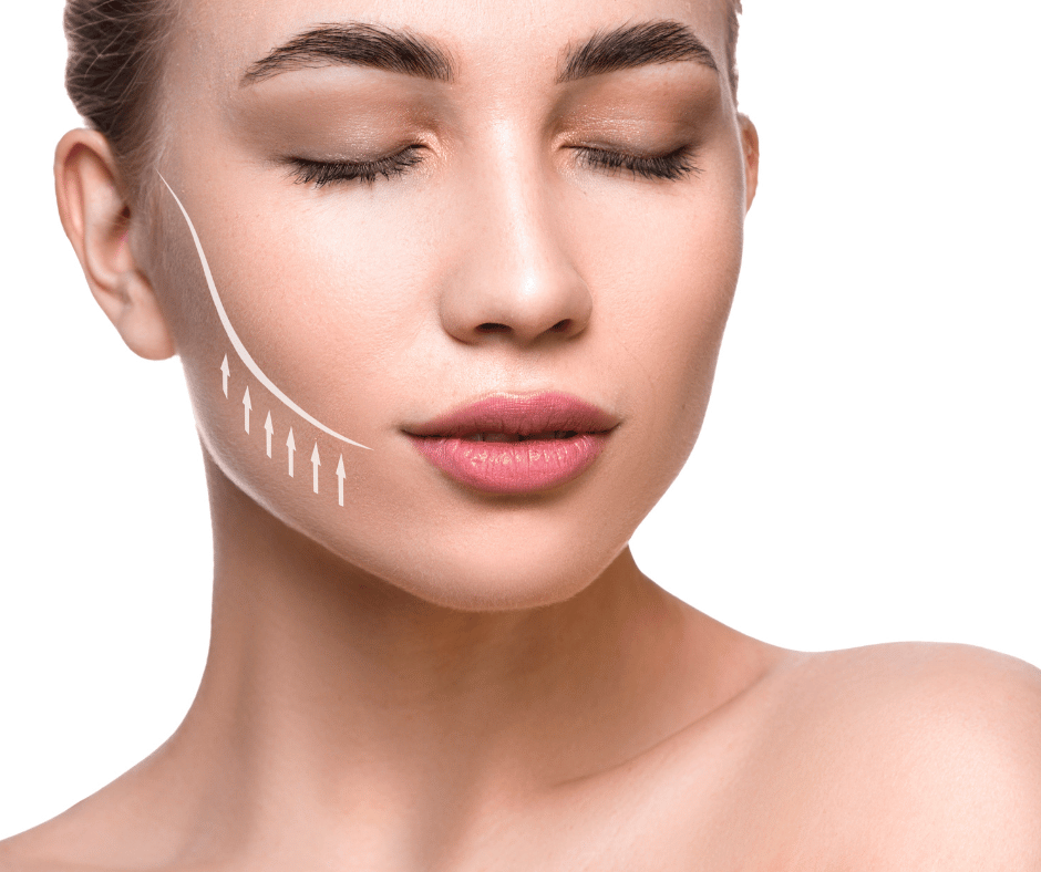 Mujer después de un lifting facial sin cirugía